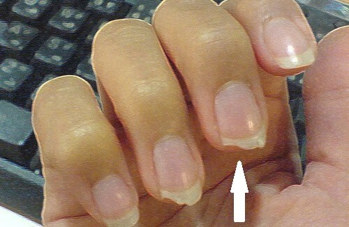 爪割れの予防策