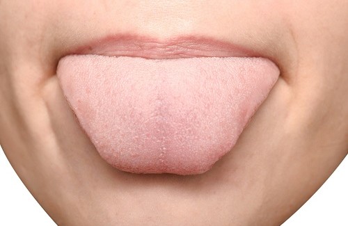 舌が示す健康状態