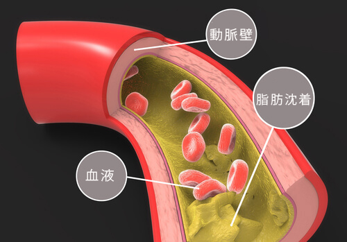Cholesterol2