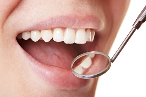 歯垢を落とす5つの方法