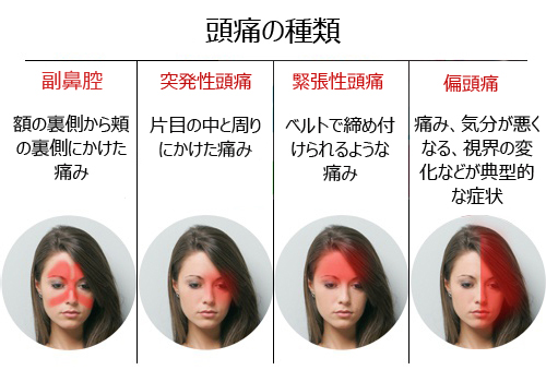 頭痛の種類