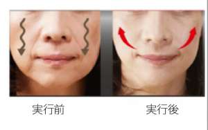 たるんだ頬を引き締める自宅でできる４つの方法