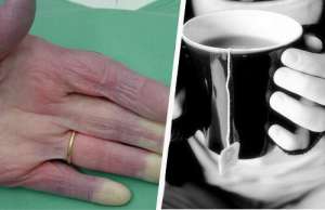 冷たい手:知っておくべきその原因