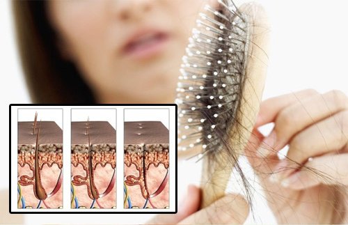 抜け毛の原因を探る 抜け毛の原因を探る
