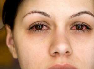 私って寝不足?睡眠が足りているかどうかを知る方法