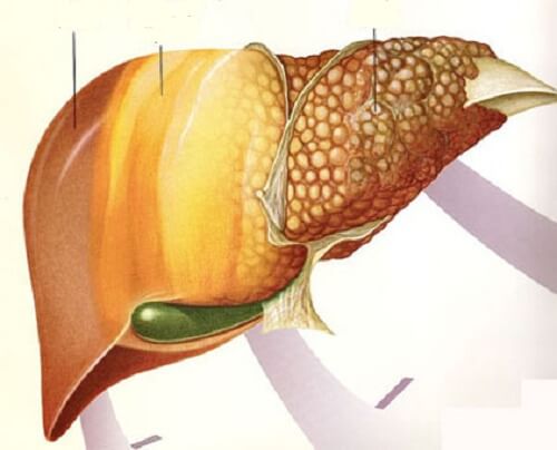 脂肪肝疾患の改善に役立つ果実