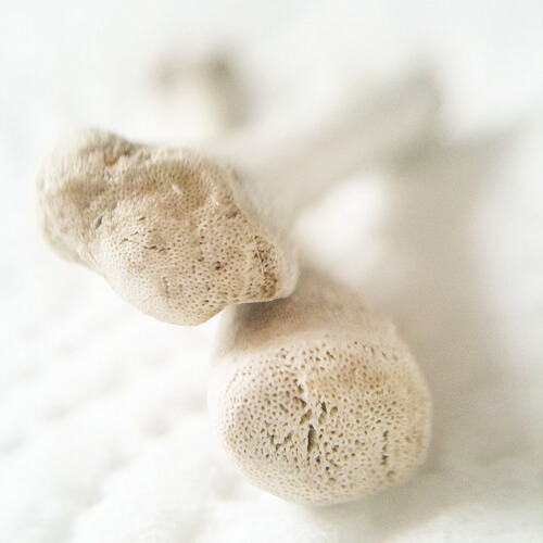 関節の音が鳴る仕組み