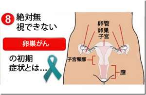 絶対無視できない/卵巣がんの8つの初発症状