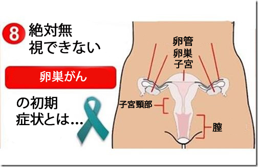 絶対無視できない/卵巣がんの8つの初発症状 絶対無視できない/卵巣がんの8つの初発症状