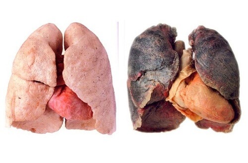 肺をきれいにする方法