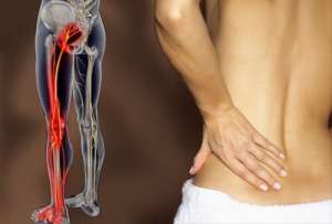 坐骨神経痛と腰痛の治療法