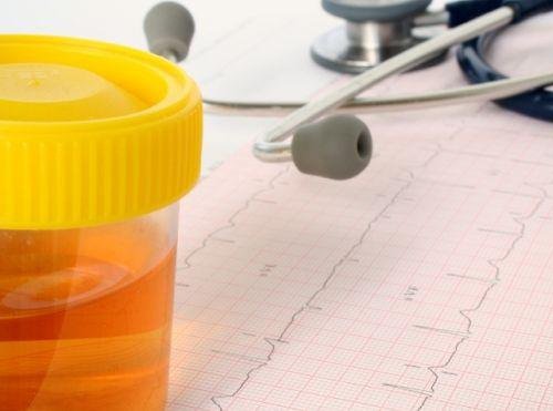 尿で健康状態が分かる