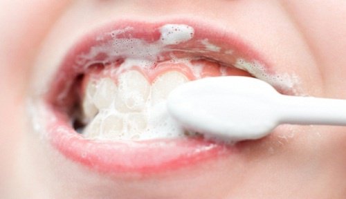 家でできる/歯のナチュラル・ホワイトニング法