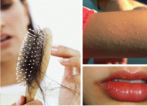 私のカラダ、なんだかヘン?/ビタミン不足の兆候とは