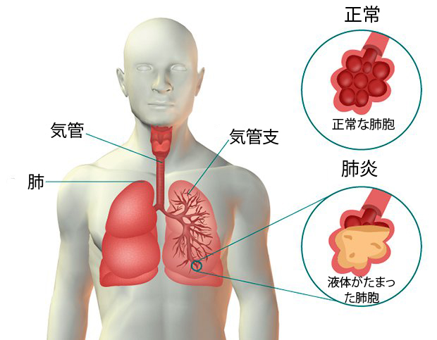 皮膚にできる白い斑点 これって一体何 みんな健康