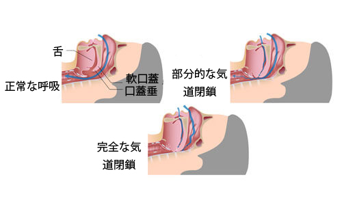 正常な呼吸