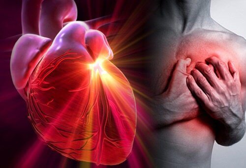 心臓発作と脳卒中の/リスクを減らす方法