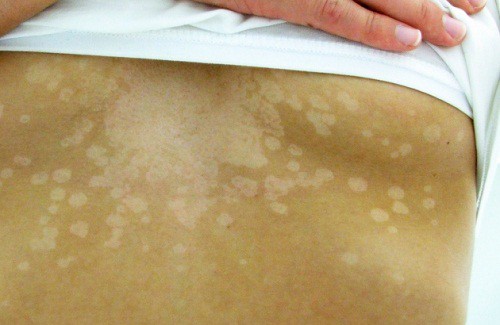 皮膚が発する健康に関するサイン５つ