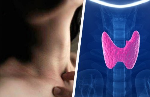 要注意! 甲状腺機能に異常をきたす6つの習慣