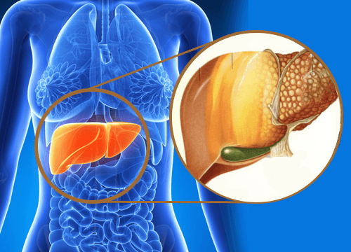 脂肪肝とその治療法について