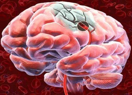 脳への血流を良くする5つの方法