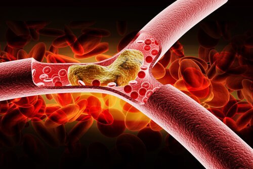 2-bloodstream