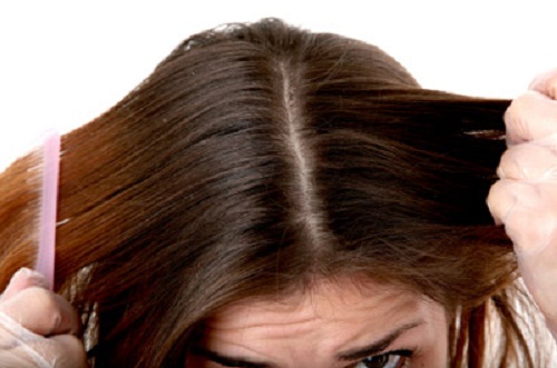2-greasy-hair