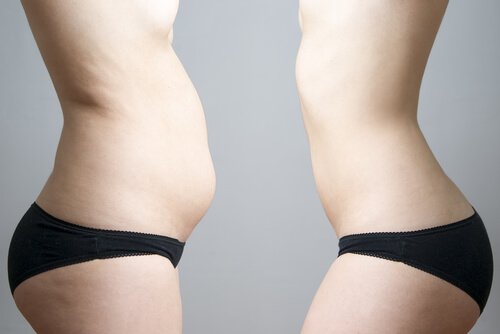 3-abdominal-fat