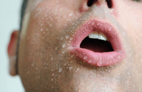 4-sweating