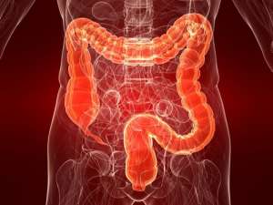 潰瘍性大腸炎: その原因、症状、治療法とは