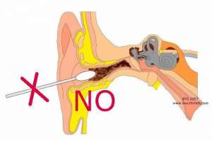耳垢掃除の6つの方法