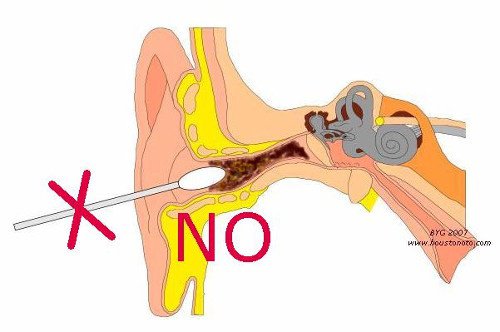 耳垢掃除の6つの方法