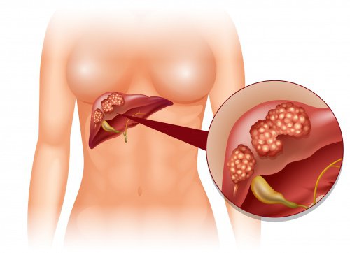 2-liver-detox