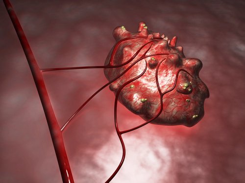 2-ovary-with-cysts
