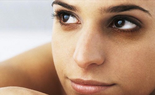 3-undereye-circles