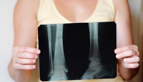 4-xray