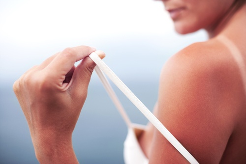 cool-sunburns
