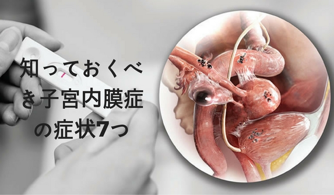 その痛み、大丈夫?子宮内膜症の症状7つ その痛み、大丈夫?子宮内膜症の症状7つ
