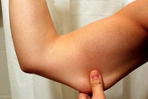 4-arm-flab