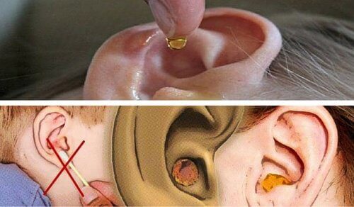 耳あかを自然に取り除く方法