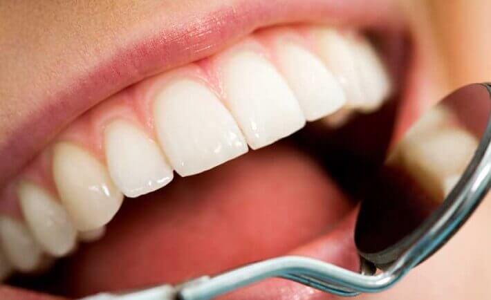 oral-health