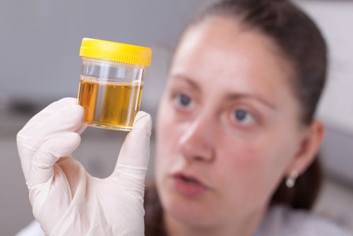 肝臓に毒素が蓄積されていることを示すサイン