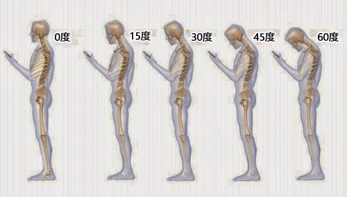 首の痛みの原因となる6つの生活習慣