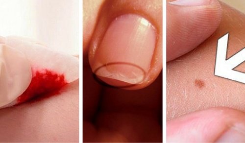 こんな時は皮膚科に行こう！無視してはいけない5つのケース