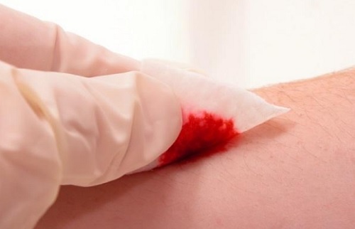 tus-heridas-tardan-en-curar-500x322