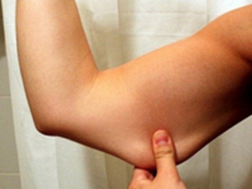 flabby_arm-1