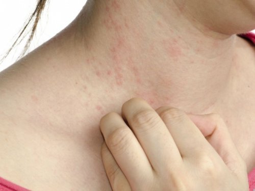 ご用心! あまり知られていない糖尿病の5つの症状とは?