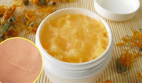 切り傷や傷あとを自然にいやす/自家製クリームの作り方