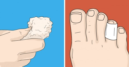 足のタコを取り除く家庭療法6種 足のタコを取り除く家庭療法6種