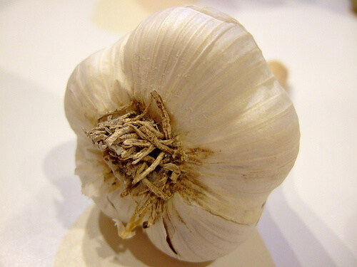 artery